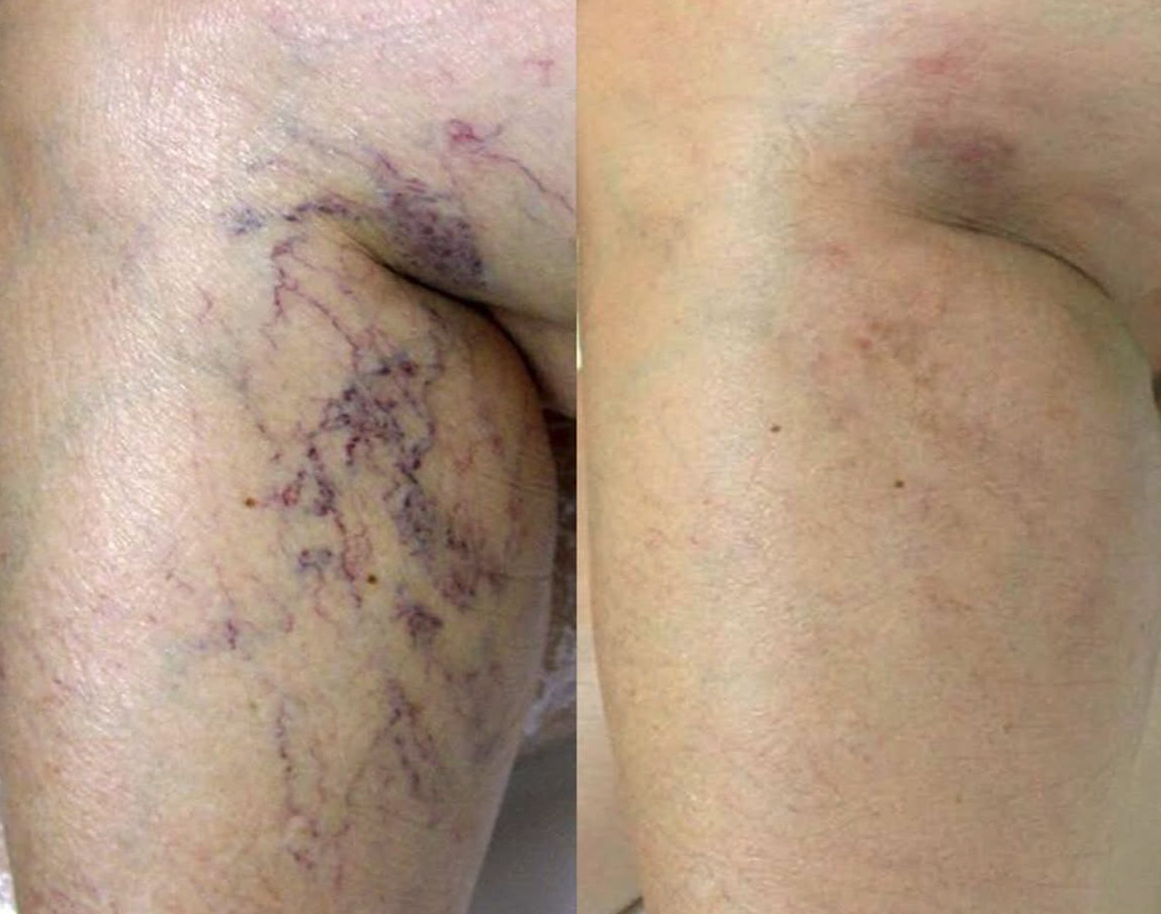 Inside the Dr. Tadros Skin Laser Clinic treatment room